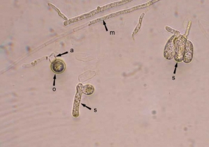 pythium_aphanidermatum