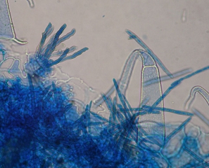 Plusieurs conidiophores émergeant d'un stomate et des conidies sont présents sur cette portion de feuille observée au microscope photonique.
<i>Pseudocercospora fuligena</i> (cercosporiose)