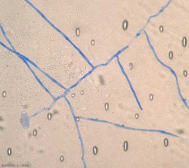 podosphaera_aphanis_12