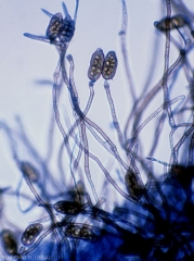 Conidiophores portant des conidies isolées de <b><i>Stemphylium solani</i></b>. (Stemphyliose - grey leaf spot)