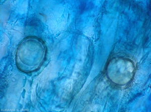 Aspect d'oospores de <b><i>Phytophthora</i> sp.</b> observées au microscope photonique. (Oomycètes)