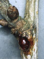 Bacteriose
