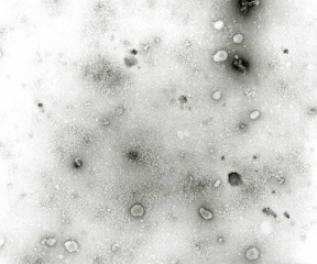 Les particules du <b><i>Mirafiori lettuce big-vein virus</i></b>
(MLBVV, virus des grosses nervures de la laitue) sont difficilement observables en microscopie électronique.