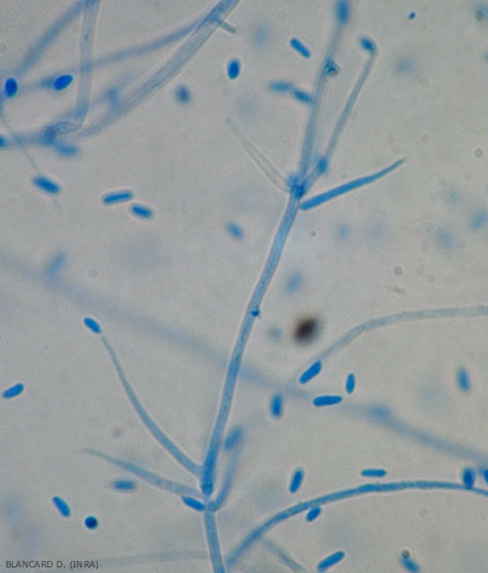 Dettaglio di un conidioforo di <b><i>Verticillium dahliae</i></b>. Una conidia è ancora presente alla sua estremità. (verticilliosi, <i>Verticillium</i> wilt).